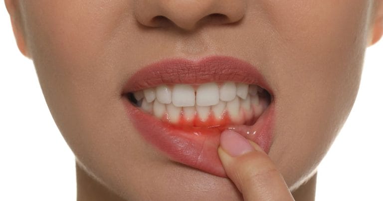 Effective & Powerful Oral Care Solutions for Bleeding Gums and Fresh Breath in Kenya (Complete 2026 Guide) | Our Mall Pharmacy