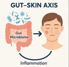 Powerful & Proven Gut Health Secrets for Clear Skin in Kenya (2026 Complete Acne Guide) | Our Mall Pharmacy